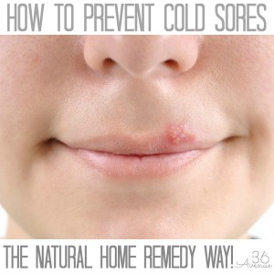 How to prevent COLD SORES at the36thavenue.com The easy NATURAL HOME REMEDY way.. You want to pin this!